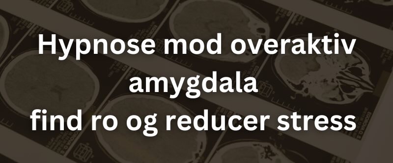 Hypnose mod Overaktiv Amygdala – Find Ro og Reducer Stress