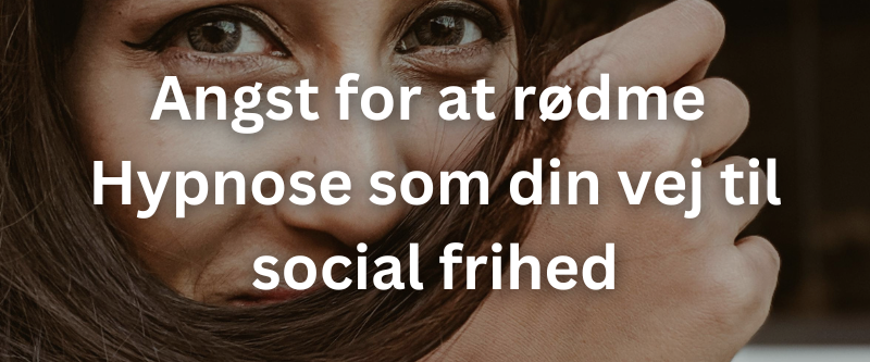Angst-for-at-rødme-hypnose